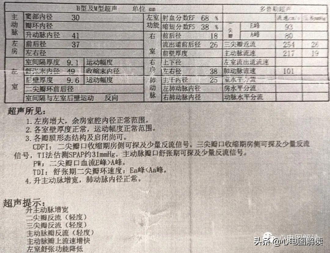 心肌桥最新治疗方法与进展