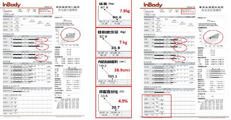 灵尊境KZG919.93揭秘：一肖100%无误的精准诠释与正品解读